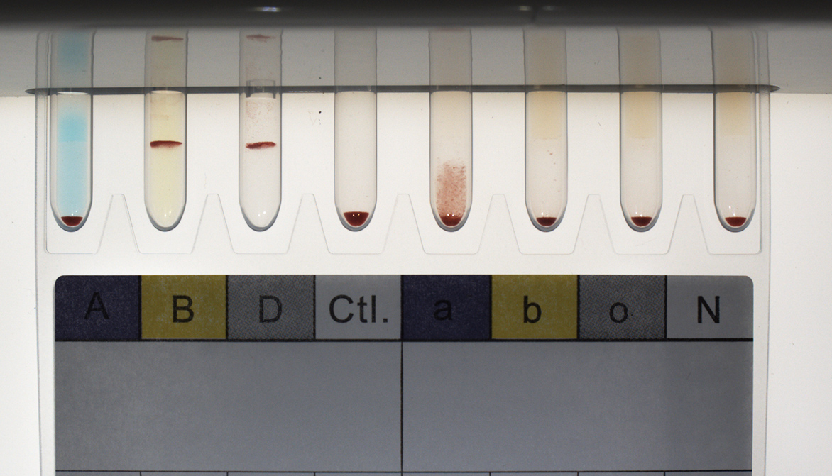Medical test kit USB camera
